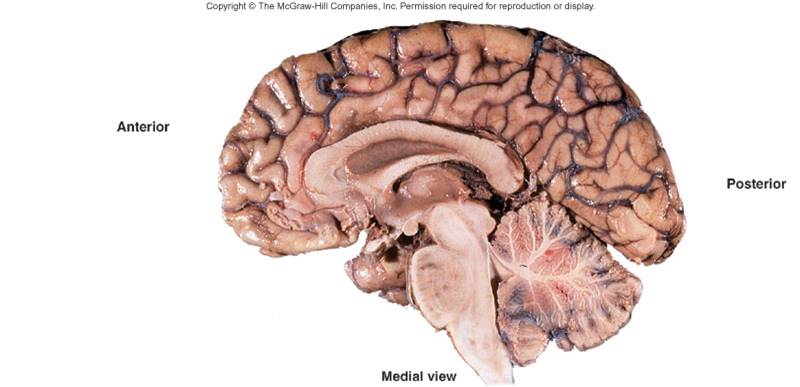 PTA 10 Sagittal Image of the Brain.jpg